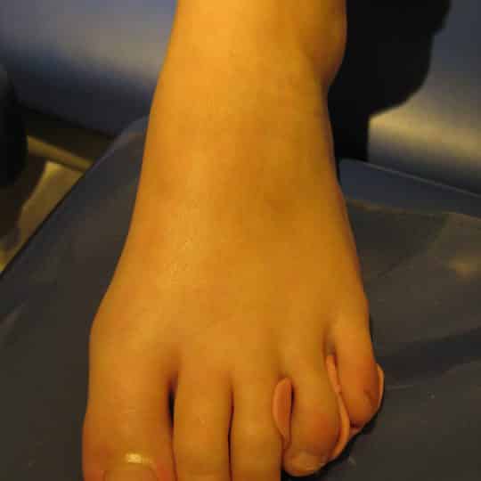 silicona pies