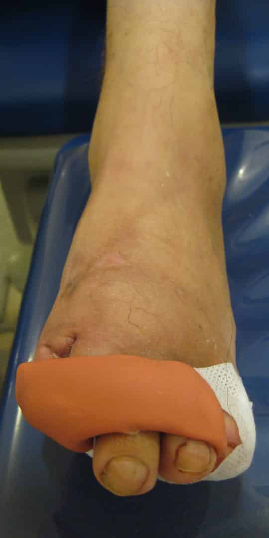 silicona pies